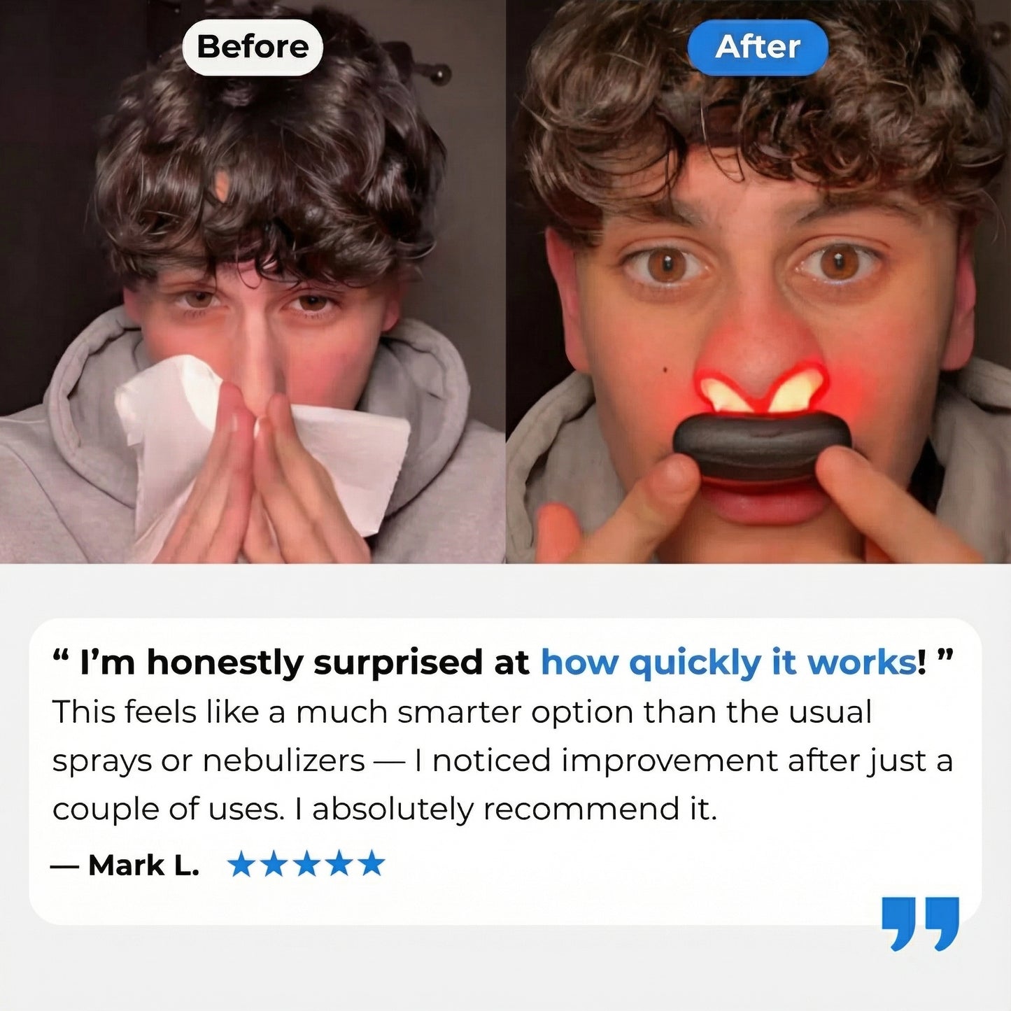 AirLuma™ Nasal Therapy Device