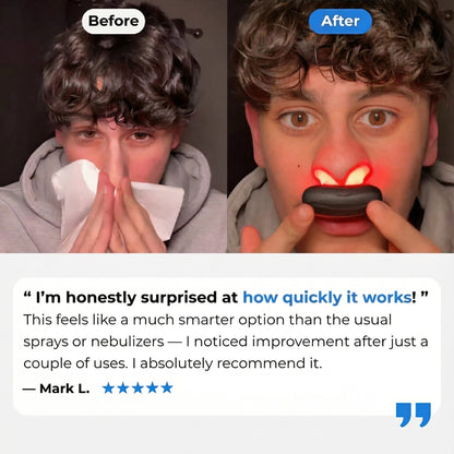 AirLuma™ Nasal Therapy Device